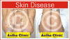 Copyright, Astha Clinic